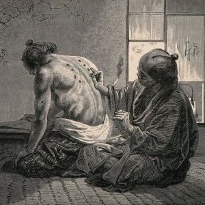 Il Morbo di Edo