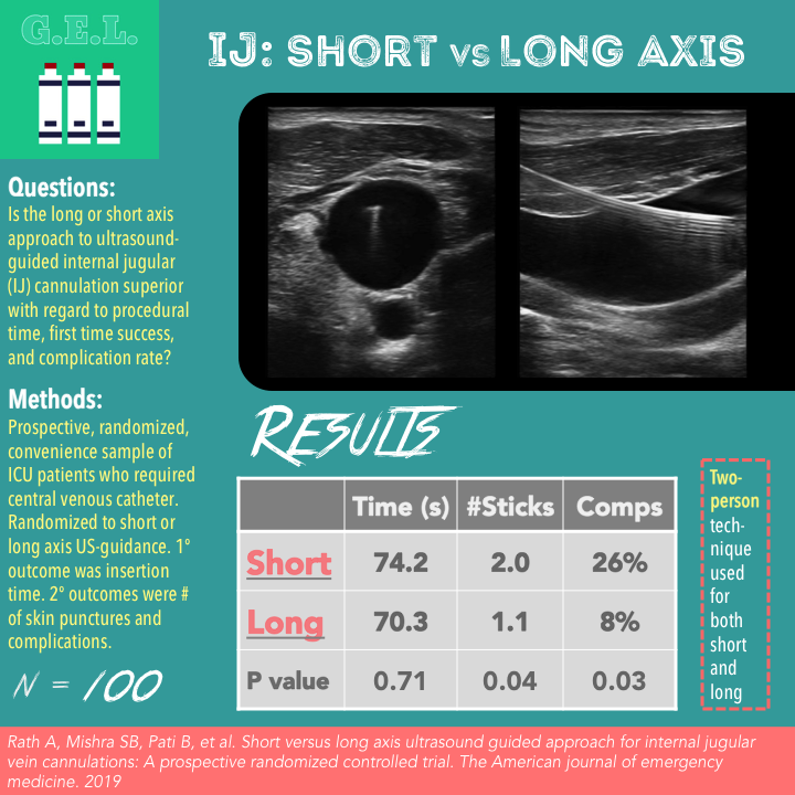 Short versus Long for IJ Cannulation Ultrasound GEL Lyssna här