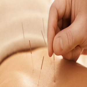 Acupuncture by Acufunkture: an old, new way to heal body, mind, & spirit.