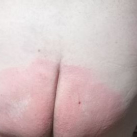 What’s Happening ”it’s all in your head” Spanking Reenactment