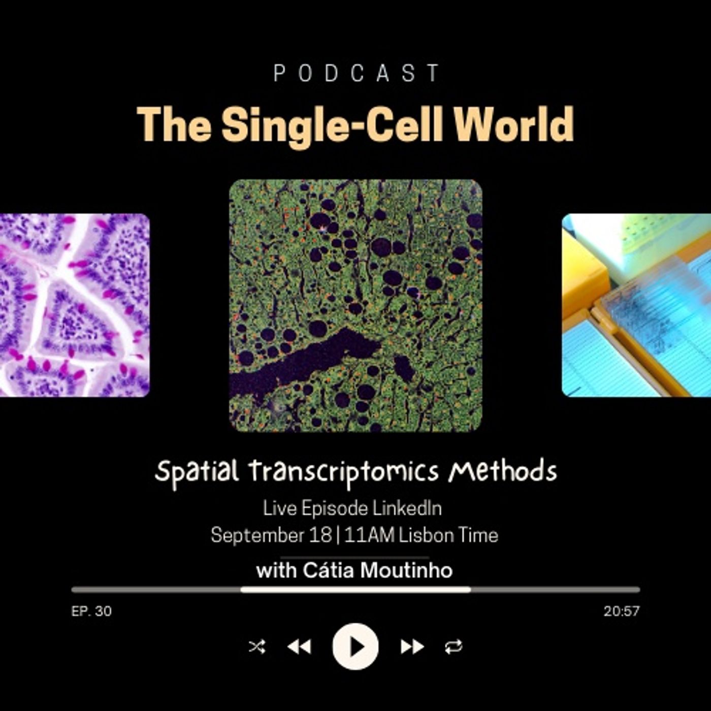 Ep. 30: Spatial Transcriptomics Methods Ep. 30: Spatial Transcriptomics Methods