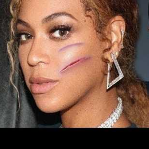 Episode 22: Who Bit Beyonce?