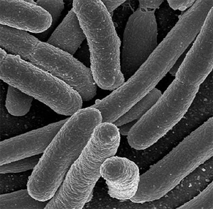 004 Microbes, the little guys_Henrietta Lacks and the origins of the HeLa cell line