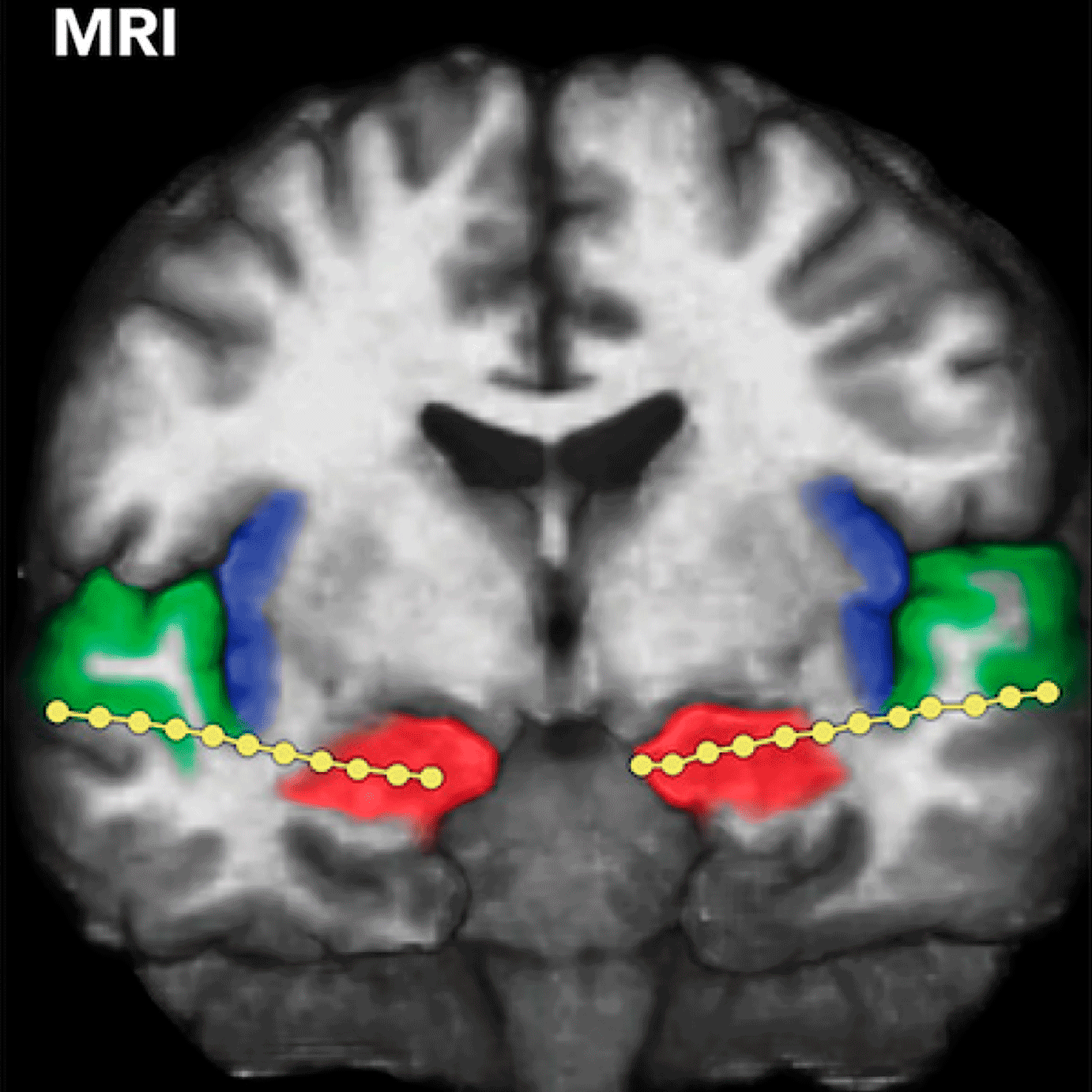 Breathing above the brain stem