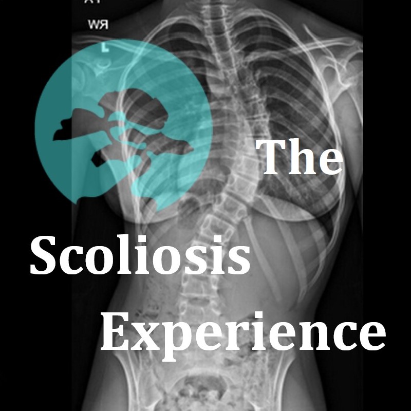 The Scoliosis Experience